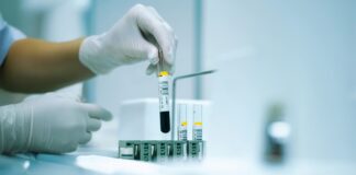 Tudatos döntés az egészségedért: mit árulnak el génjeid a családtervezésről, daganatkockázatról és a szív-agy egészségről?